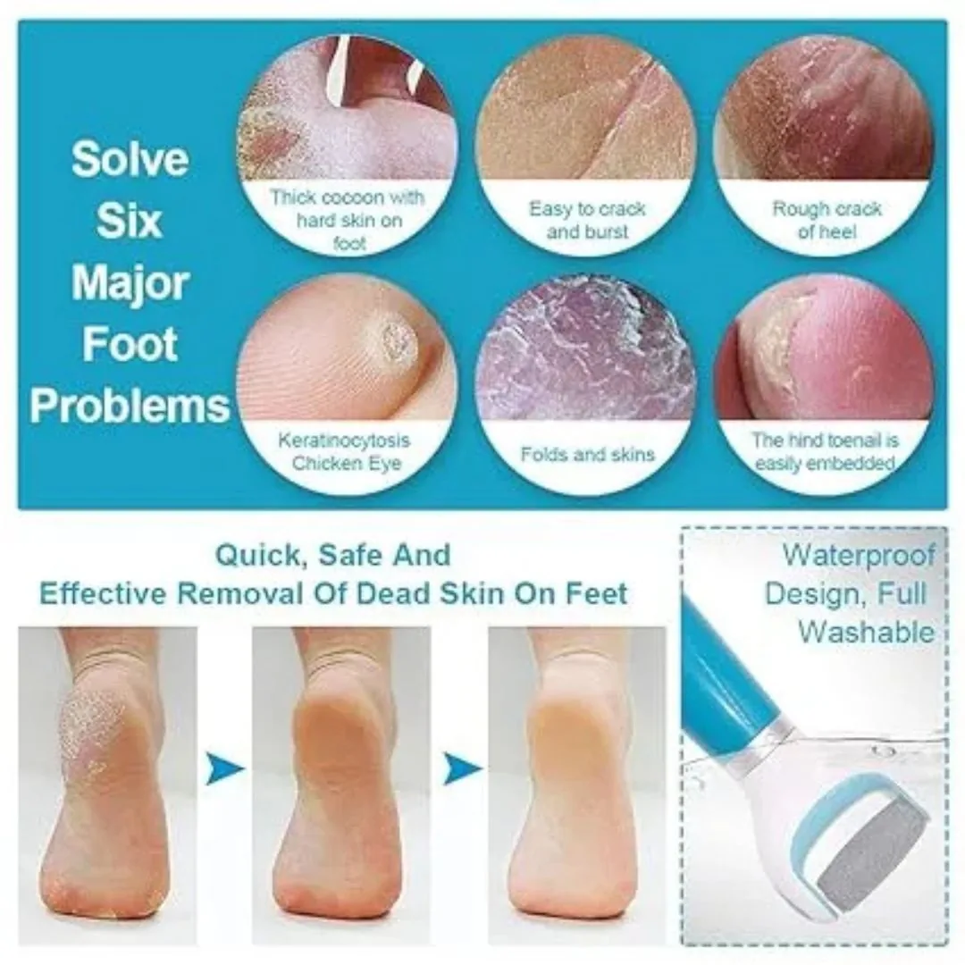 Electric Foot Callus Remover & Rechargeable Pedicure File | Hard Skin & Dead Skin Remover Tool for Smooth Feet image 7