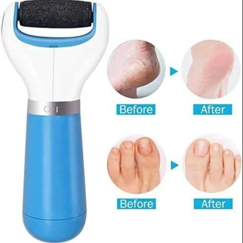 Electric Foot Callus Remover & Rechargeable Pedicure File | Hard Skin & Dead Skin Remover Tool for Smooth Feet image 6