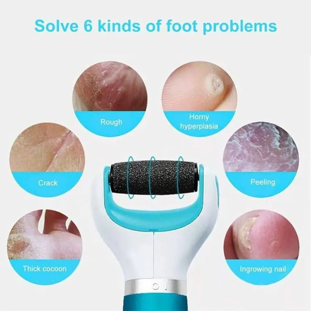 Electric Foot Callus Remover & Rechargeable Pedicure File | Hard Skin & Dead Skin Remover Tool for Smooth Feet image 8